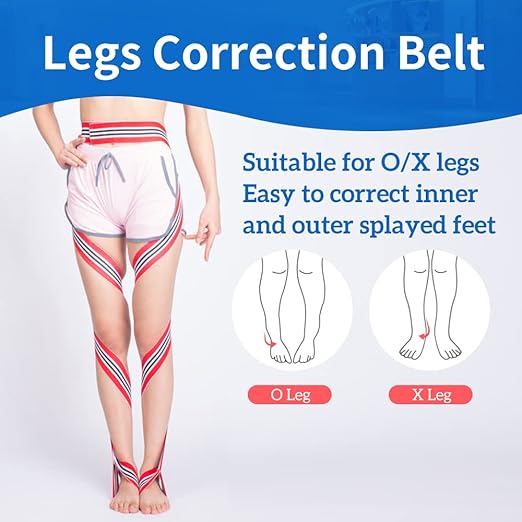 GHORTHOUD O/X Legs Correction Belt Legs Posture Corrector Band Unisex O/X Legs Type Legs Bandage Lightweight Pediatric Straighten Belt for Men Women and Children for Day and Night (Small)