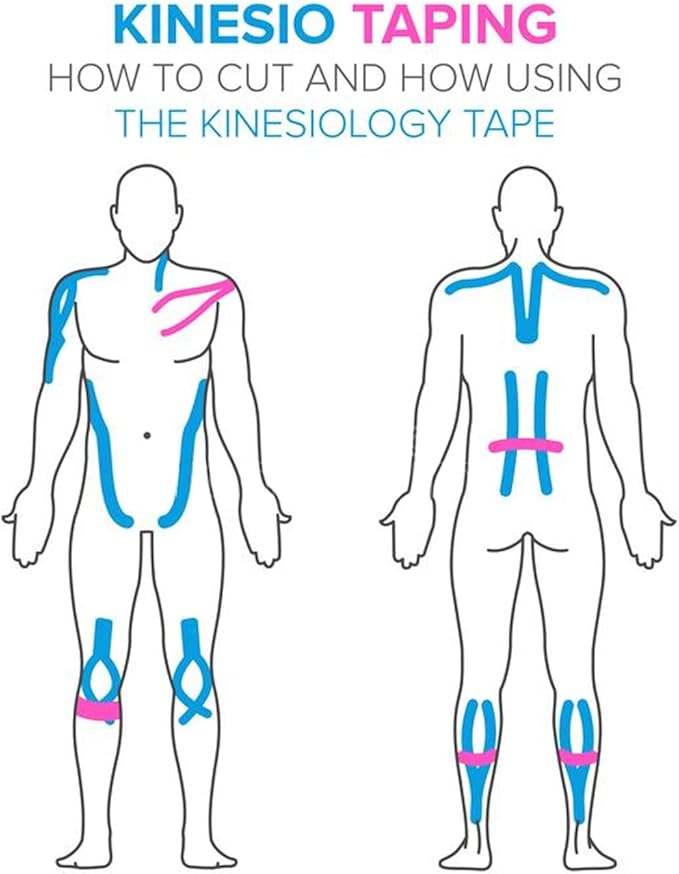 Kinesiology Tape<20 Precut Strips>Pro Elastic Athletic Tape,Cotton Waterproof Breathable Hypoallergenic Sport Tape for Joints Support & Muscle Pain Relief(Skin Color)