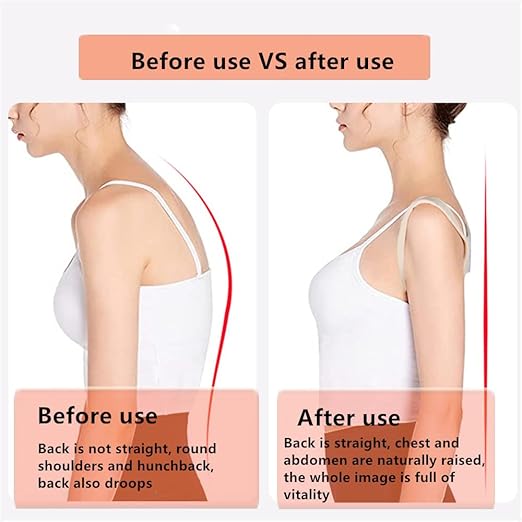 Posture Corrector for Women and Men,Breathable Hunchback Corrector,Adjustable Back Straightener Brace Suitable for Back,Shoulder and Spine Pain Relief（Beige，L）
