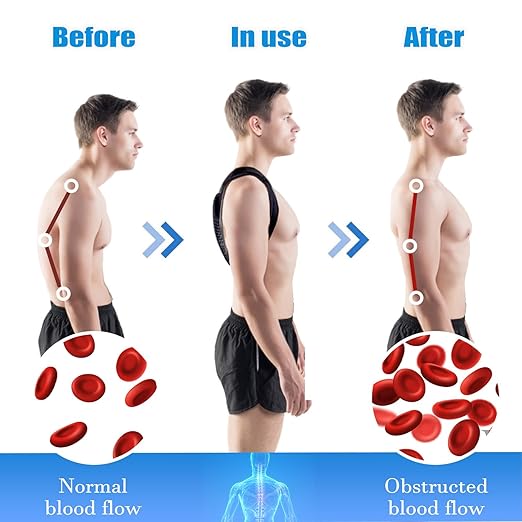 Posture Corrector Brace, Adjustable Back Support for Women and Men (Medium（105-143 LB）)