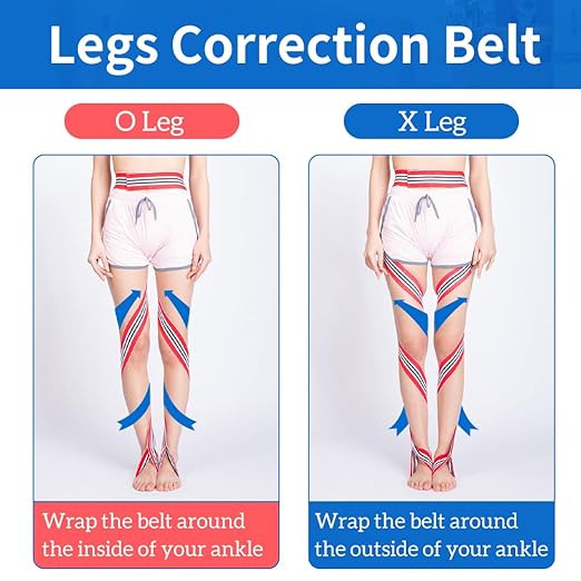 GHORTHOUD O/X Legs Correction Belt Legs Posture Corrector Band Unisex O/X Legs Type Legs Bandage Lightweight Pediatric Straighten Belt for Men Women and Children for Day and Night (Medium)
