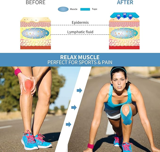 REFUN Kinesiology Tape Precut (4 Rolls Pack), Elastic Therapeutic Sports Tape for Knee Shoulder and Elbow, Pain Relief, Waterproof, Latex Free, 2" x 16.5 feet Per Roll, 20 Precut 10 Inch Strips Beige