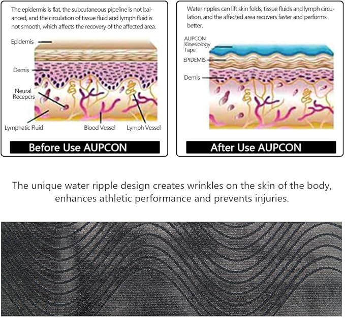 AUPCON Kinesiology Tape Elastic Tape Hypoallergenic Breathable Cotton Sports Muscle Tape Adhesive Tapes for Medical Purposes